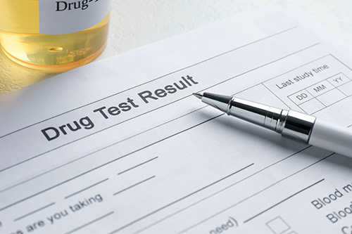 Document displaying drug test results, crucial for understanding truck accident claims and the need for specialized knowledge.